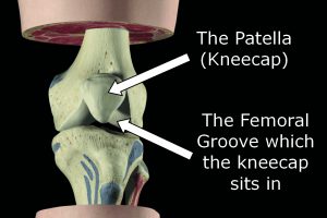 patella tendon in formal groove